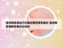 福州银屑病治疗的最好医院哪家最好 福州银屑病哪家看的比较好
