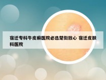 宿迁专科牛皮癣医院必选楚街放心 宿迁皮肤科医院