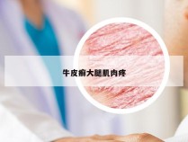 牛皮癣大腿肌肉疼