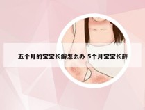 五个月的宝宝长癣怎么办 5个月宝宝长藓