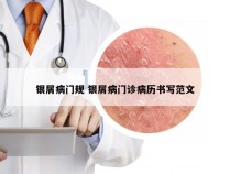 银屑病门规 银屑病门诊病历书写范文