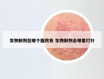 生物制剂在哪个医院有 生物制剂去哪里打针