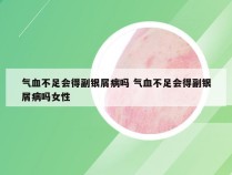 气血不足会得副银屑病吗 气血不足会得副银屑病吗女性