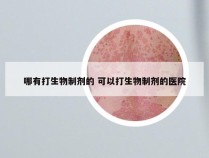 哪有打生物制剂的 可以打生物制剂的医院