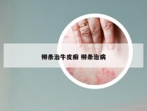 柳条治牛皮癣 柳条治病