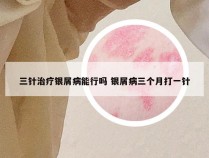 三针治疗银屑病能行吗 银屑病三个月打一针