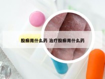 股癣用什么药 治疗股癣用什么药