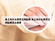 身上为什么突然之间起癣 身上为什么突然之间起癣怎么回事