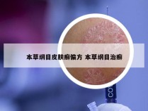 本草纲目皮肤癣偏方 本草纲目治癣