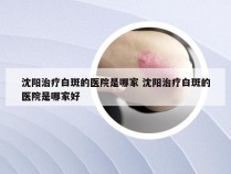 沈阳治疗白斑的医院是哪家 沈阳治疗白斑的医院是哪家好