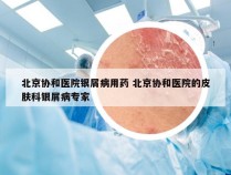北京协和医院银屑病用药 北京协和医院的皮肤科银屑病专家