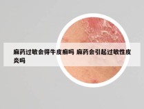 麻药过敏会得牛皮癣吗 麻药会引起过敏性皮炎吗