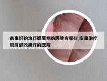 南京好的治疗银屑病的医院有哪些 南京治疗银屑病效果好的医院