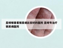 昆明哪里看银屑病比较好的医院 昆明专治疗银屑病医院