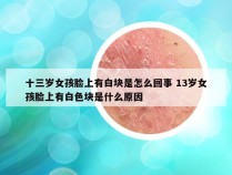 十三岁女孩脸上有白块是怎么回事 13岁女孩脸上有白色块是什么原因