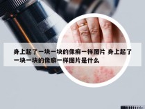 身上起了一块一块的像癣一样图片 身上起了一块一块的像癣一样图片是什么