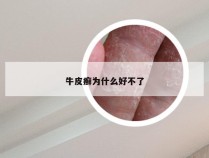 牛皮癣为什么好不了