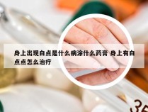 身上出现白点是什么病涂什么药膏 身上有白点点怎么治疗