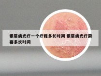 银屑病光疗一个疗程多长时间 银屑病光疗需要多长时间