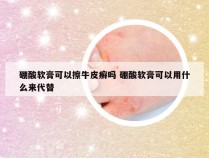 硼酸软膏可以擦牛皮癣吗 硼酸软膏可以用什么来代替