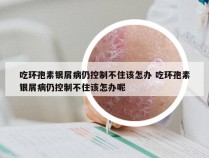 吃环孢素银屑病仍控制不住该怎办 吃环孢素银屑病仍控制不住该怎办呢