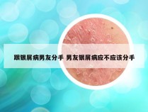 跟银屑病男友分手 男友银屑病应不应该分手
