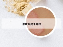 牛皮癣属于哪种
