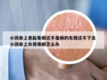 小孩身上老起象癣还不是癣的东西还不下去 小孩身上长得像癣怎么办