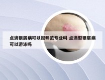 点滴银屑病可以报师范专业吗 点滴型银屑病可以游泳吗