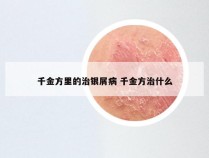千金方里的治银屑病 千金方治什么