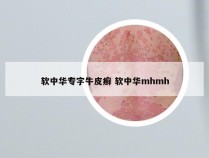 软中华专字牛皮癣 软中华mhmh
