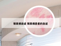 银屑病自述 银屑病患者的自述