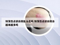 特发性点状白斑能治愈吗 特发性点状白斑会越来越多吗