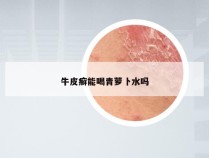 牛皮癣能喝青萝卜水吗