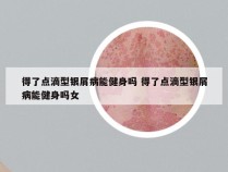 得了点滴型银屑病能健身吗 得了点滴型银屑病能健身吗女