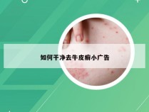 如何干净去牛皮癣小广告