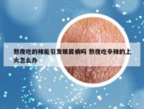 熬夜吃的辣能引发银屑病吗 熬夜吃辛辣的上火怎么办