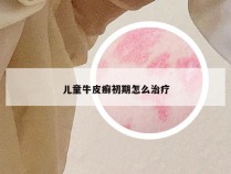 儿童牛皮癣初期怎么治疗