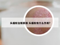 头痛粉治银屑病 头痛粉有什么作用?