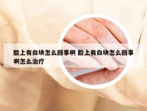 脸上有白块怎么回事啊 脸上有白块怎么回事啊怎么治疗