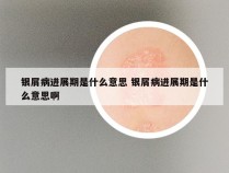 银屑病进展期是什么意思 银屑病进展期是什么意思啊