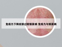 免疫力下降皮肤过敏银屑病 免疫力与银屑病