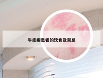 牛皮癣患者的饮食及禁忌