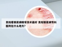 贵阳看银屑病哪家技术最好 贵阳银屑病专科医院在什么地方?