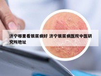 济宁哪里看银屑病好 济宁银屑病医院中医研究所地址
