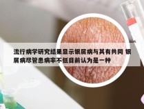 流行病学研究结果显示银屑病与其有共同 银屑病尽管患病率不低目前认为是一种