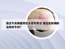 宿迁牛皮癣医院优先楚街专注 宿迁皮肤病防治所好不好?