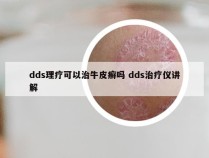 dds理疗可以治牛皮癣吗 dds治疗仪讲解