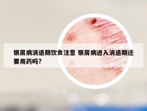 银屑病消退期饮食注意 银屑病进入消退期还要用药吗?