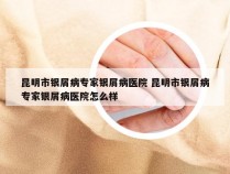 昆明市银屑病专家银屑病医院 昆明市银屑病专家银屑病医院怎么样